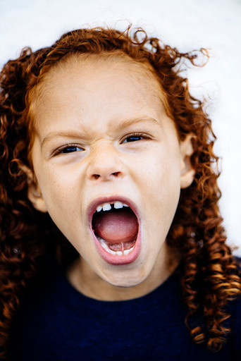 MC1R by michelle marshall