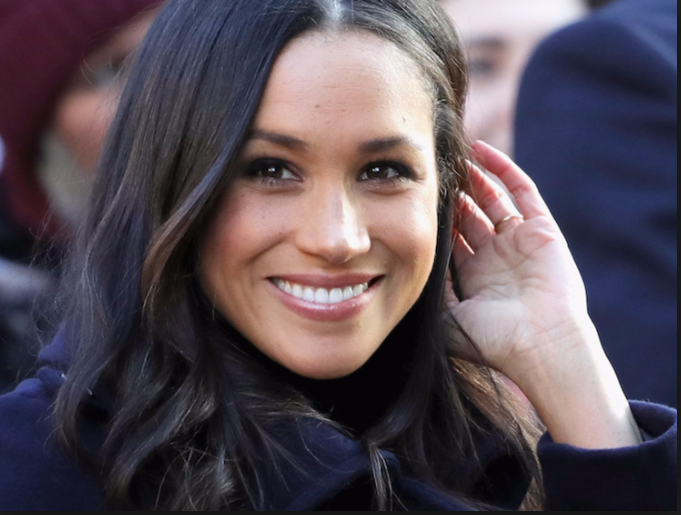 Get a smile like Meghan Markle for your big day