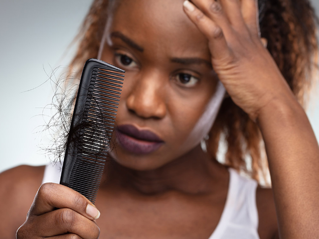 Afro hair transplants– here’s all you need to know