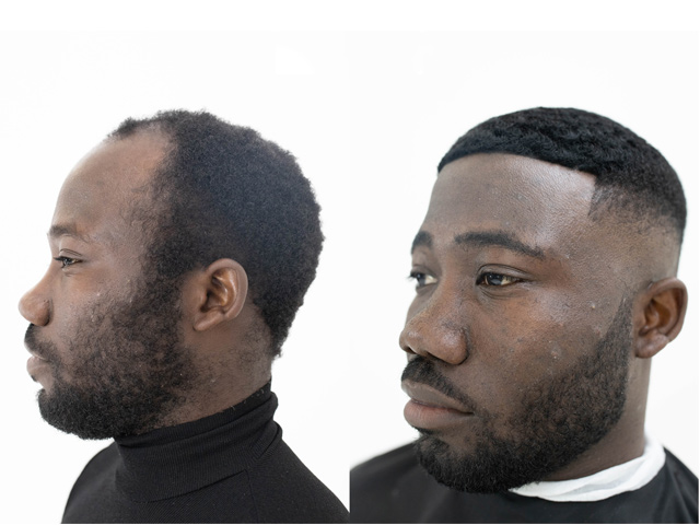 Black founders offer a unique solution for male hair loss |