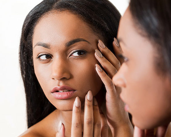 How These Expert Tips Could Help Your Adult Acne