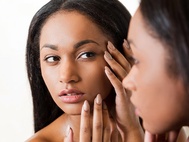 How These Expert Tips Could Help Your Adult Acne