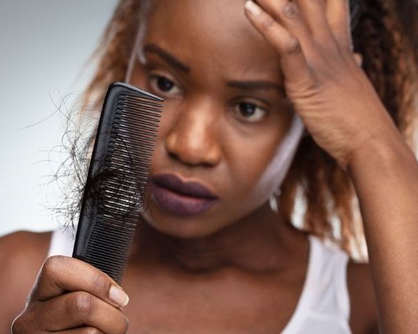 How This Treatment For Hair Loss Gave Effective Results