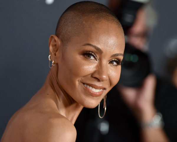 Expert Discusses Why We Should be Sensitive About Alopecia