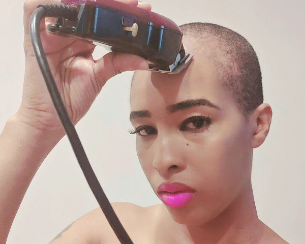 Look at Me Now! I’m Not Allowing my Hair Loss to Define Me