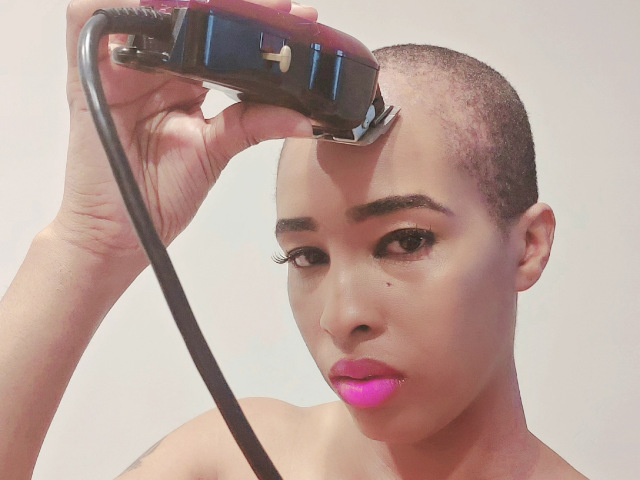 Look at Me Now! I'm Not Allowing my Hair Loss to Define Me